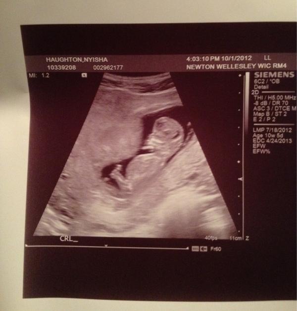 NyishaHaughton's tweet photo. 16 weeks today! Four more weeks and I'm half way there. Excited! #babydueinapril #namesuggestions http://t.co/eux1Ndv6