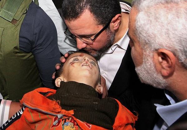 Gömülü resim için kalıcı bağlantı