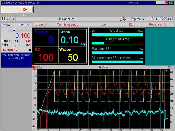 juanluqueroldan's tweet photo. Hoy cardgirus 14 series de 1,5 min a 320 vatios con la cadencia 70-75. Un poco tedioso pero llevadero. Pulso controlado http://t.co/Z8qdEla4