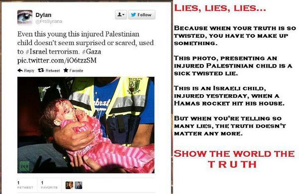 taltali's tweet photo. #Hamas lies again. Publishes a picture of an Israeli injured infant and claiming it's Palestinian. PLS RT  #Lies #Gaza http://t.co/96E1raEj