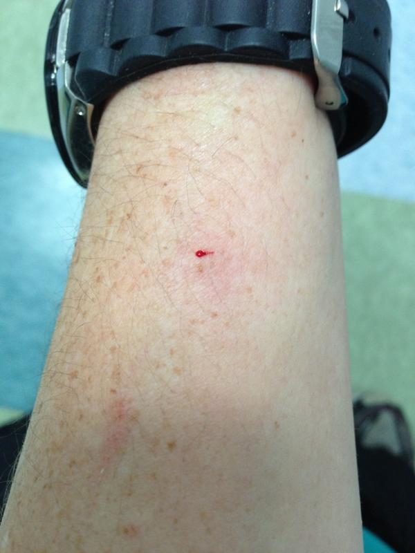 MsAmbitchous's tweet image. Thank u cat for using my arm as a spring board and digging ur disgusting claw into my arm. #bastard #hurtslikeabitch