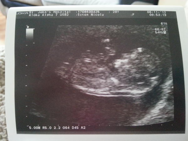 NsNicki's tweet photo. Can finally let people know we're having a wee mini Meighan :-) due 23rd May http://t.co/c4iq4rZ1