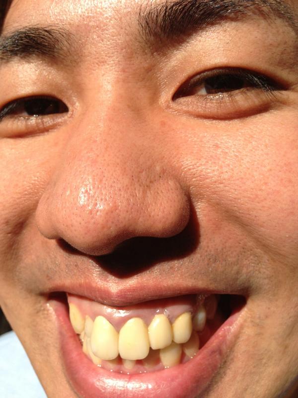 ガリットチュウ福島 Ar Twitter 大西ライオンくん とびっきりの笑顔 待ち受け画面にオススメします 是非 Http T Co 31t793om ガリットチュウ福島 Ar Twitter 大西ライオンくん とびっきりの笑顔 待ち受け画面にオススメします 是非 Http T Co 31t793om