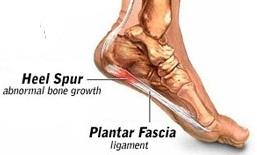 Voor de 3de x in 12 jaar geveld door Hielsporen. Spoedig herstel lijkt onwaarschijnlijk. 1ste x 5 jaar, 2de x 1 jaar.