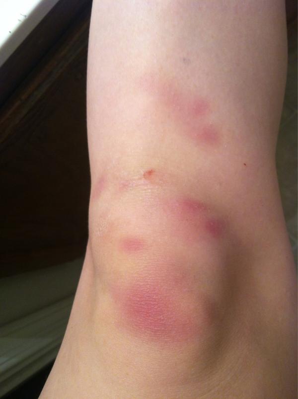 schmitt_morgan's tweet image. #pomproblems