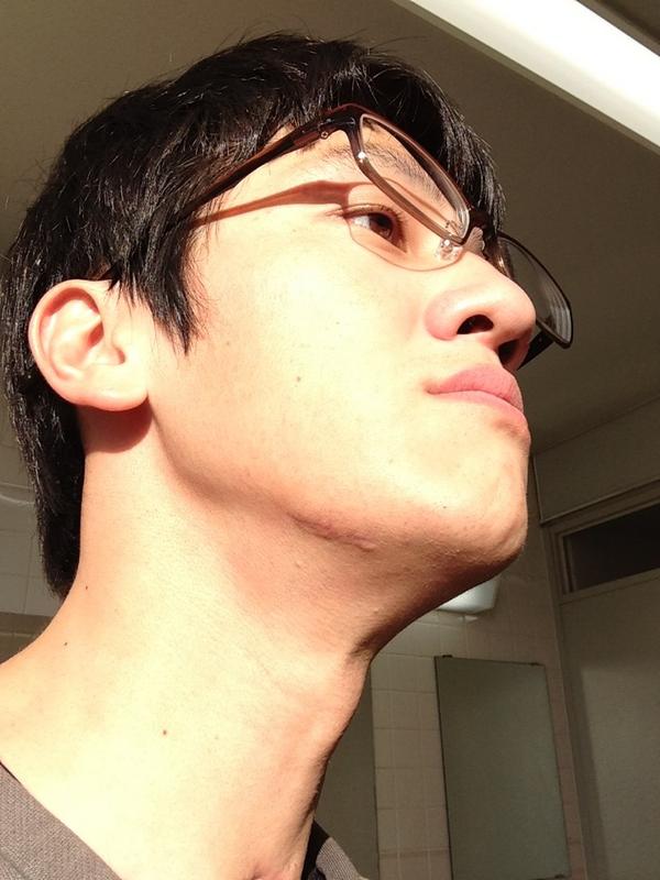 Junpei 顎の怪我 一ヶ月以上たってるからかなり治ってる他に外傷はないから ここに当たったのが脳に強いダメージを与えたらしい 先生曰く ヘルメット 関係ないやーーん Http T Co Hmgnbgl Junpei 顎の怪我 一ヶ月以上たってるからかなり治ってる他に外傷はないから ここに当たったのが脳に強いダメージを与えたらしい 先生曰く ヘルメット 関係ないやーーん Http T Co Hmgnbgl
