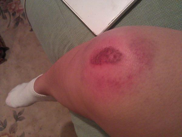 PopularGigi's tweet image. I was too drunk to even feel this now I can't even walk :( #ateshitatdennys #soembarrasing #everyonesaw