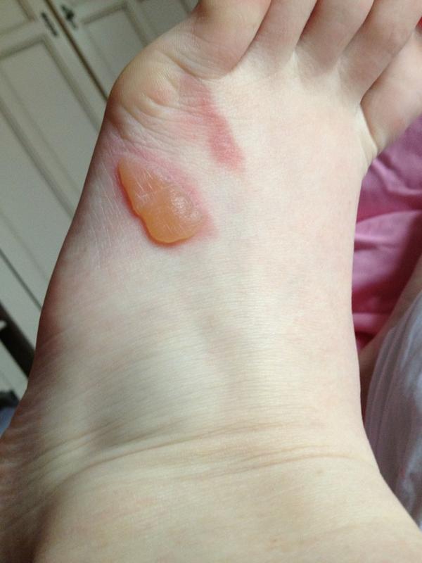 rachaelminahan's tweet image. Never drop a chicken pie on your foot #Anging