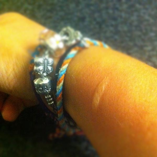 Woman really shouldn't be in the kitchen when kitchens are soo dangerous.... #burn #sore
