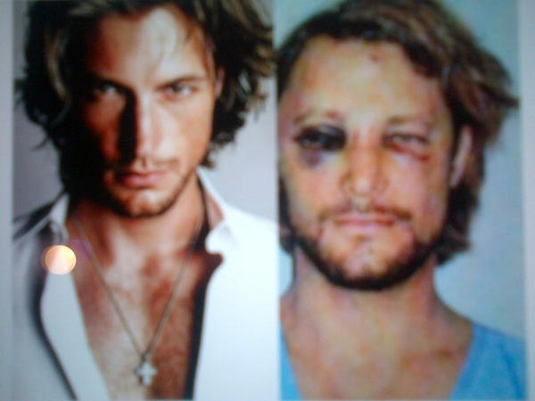 ElMarquesitoPty's tweet image. Ergggga y asi quedo el ex de Halle Berry luego que el novio actual le dio una sacada d chu#*. #Atenercuidado #Violentbf