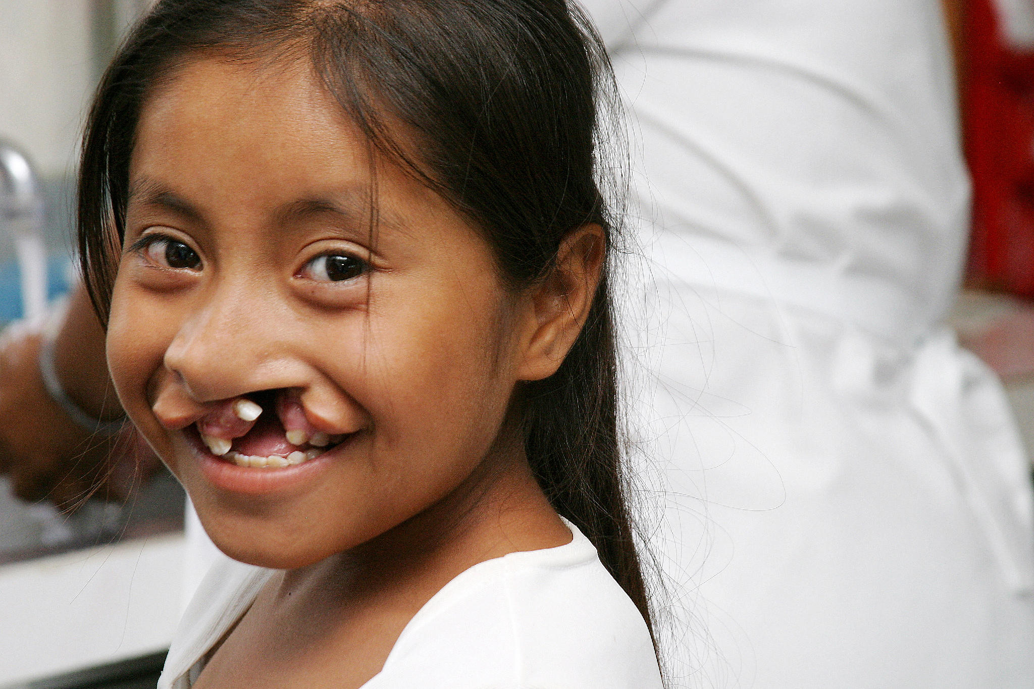 Smile Network On Twitter A Beautiful 12 Year Old Girl From Mexico Has 