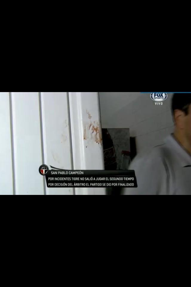 A99igczCUAI2_ry.jpg:large