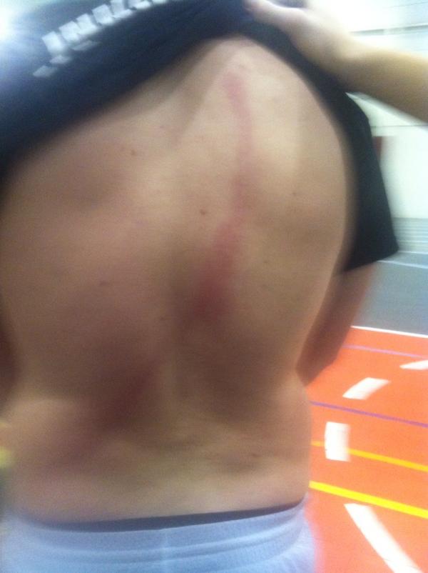 BuffaloBSic's tweet image. Fell down after one of my throws right on the ring #throwersproblems