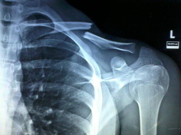 kaknannn's tweet image. malem ini ngacak2 kosan nyari kabel LAN eh yg ketemu malah ini! #cacad