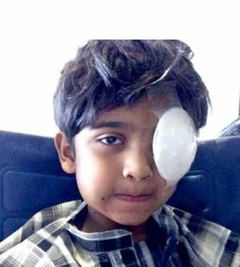 Ahmed AlNahham lost his eye due 2shotgun pellets when all he was doing was sitting by his Dad in the market #SaveBhKids