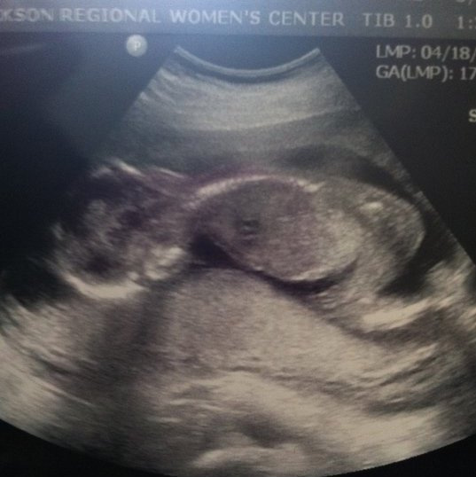 JessycaCavierah's tweet photo. my little guy http://t.co/FWV05A2