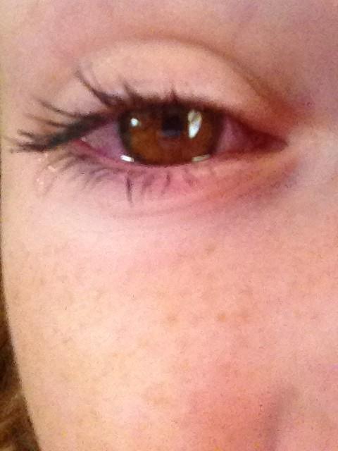 tROSS_daBOSS's tweet image. Never sleeping in my contacts again #owchie