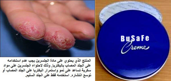 BuSaFe's tweet photo. الكريم المحتوي على الجلسرين يغذي البكتريا على الجلد, استخدمه فقط على الجلد السليم #صحة http://t.co/wtMEuPea