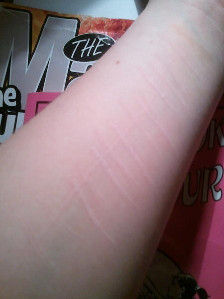 Lovely_Scars's tweet photo. Just scars now http://t.co/vw6wL6u1