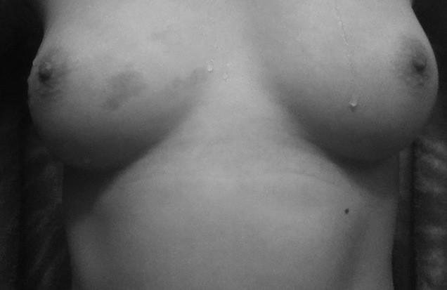 Interesting fact about me... I have a birthmark on my right boob. It shows most after I get out of the<a href="/tag/womenknowwhatwomenwant"class="tags"><span>#womenknowwhatwomenwant</span></a>