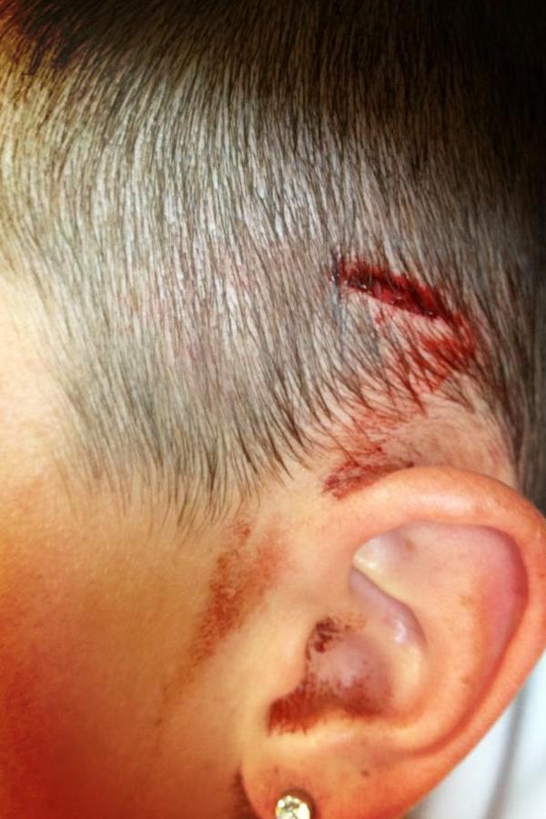 MasonIrvine's tweet photo. It's hurts @kirvine19 http://t.co/bR0ruxbt