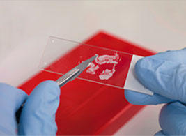 KRAS_Info's tweet image. סרטן המעי הגס - לא גזר דין מוות
tinyurl.com/ajhepsz