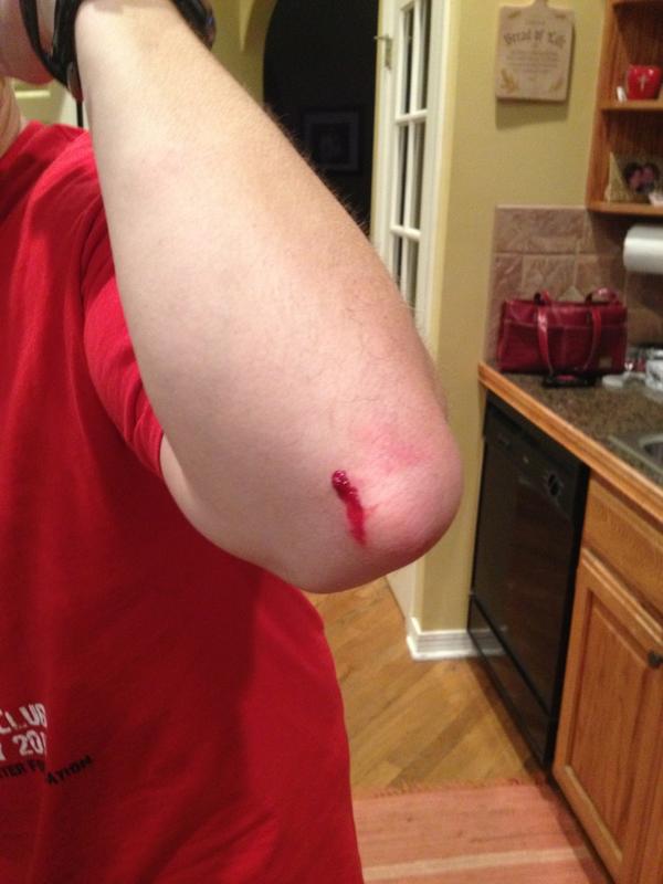 Pat6Allen's tweet image. Bike time first day of 2013-check. Goals set-check. Bike come off of trainer and crash-check!!!!  #diditwrong