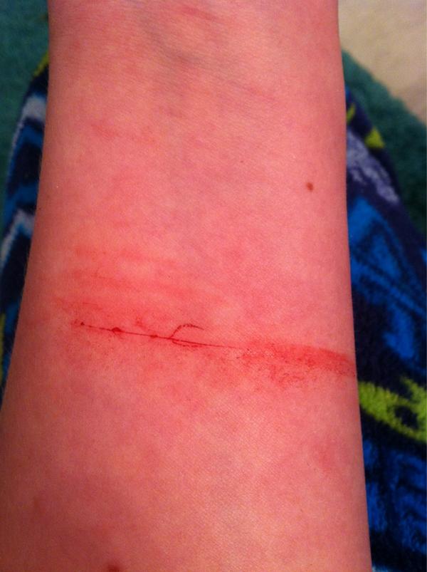 DrowningAlone's tweet photo. i waited until it was done bleeding to take a picture. http://t.co/T3b3oJNi
