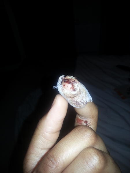 jazzC2's tweet photo. removing the bandage last night http://t.co/nvRfvSyH