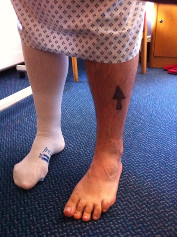 JC1971's tweet photo. Which leg is it? http://t.co/MNUOClnv