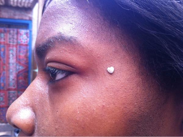 NoKaOiTiki's tweet image. Healed facial surface anchor by Luis @bodmodkub with @ANATOMETAL threaded heart #piercing #surfaceanchor #microdermal