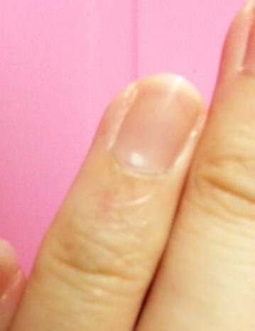 しおり 左手の薬指の爪に白い点が 爪の白い点は 幸運期到来 の印らしい ちなみに薬指は結婚運ｕｐらしい ほんまかいな Http T Co Tpdhakkg