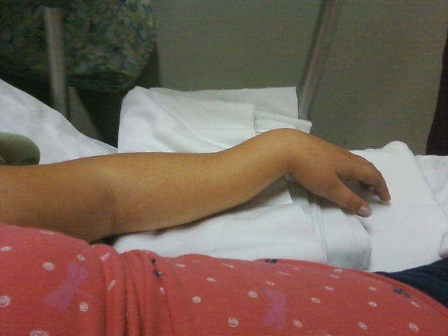 My poor little niece broke her arm :(... Gotta love those monkey bars. http://t.co/mmI5Y6at<a href="/tag/eros"class="tags"><span>#eros</span></a>