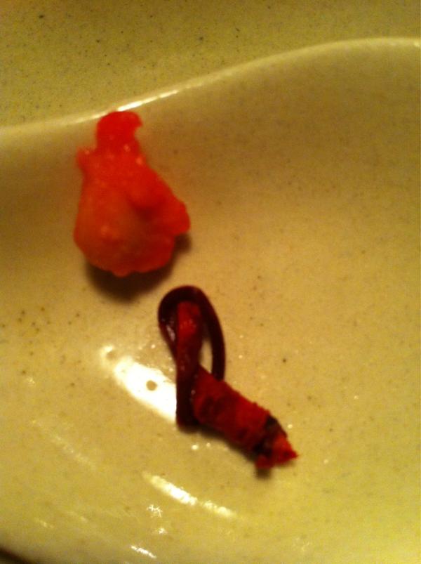 mi_little's tweet photo. わたくし、さくらんぼのへた口の中で結べます。 http://t.co/ReY5rn3m