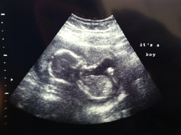 It's a Boy! Meet Jacob Alexander Oms :)