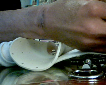 PokeDax's tweet photo. screw surgeries that you don't need http://t.co/mgGDxgQr