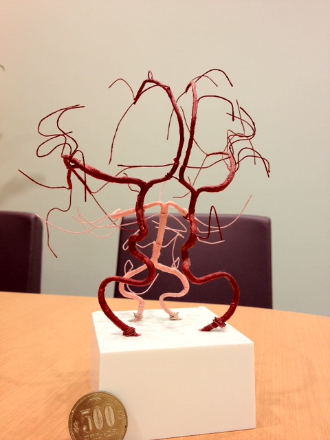 募集開始】なかなかイメージが沸き難い脳血管の立体図式、コメディカル