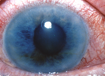 SaludColombia's tweet photo. Que es el Glaucoma? Cual es el riesgo de padecer Glaucoma? http://t.co/SAPwdFWX #Salud #Glaucoma #Medicina http://t.co/Me4uNnvR