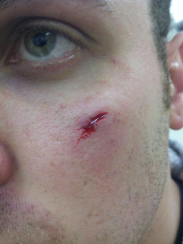 jbossman5's tweet image. This blows #faceproblems