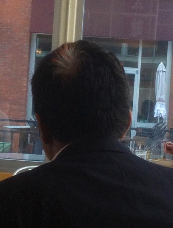 Mylesevan's tweet image. Nice patch #Signsofgettingold