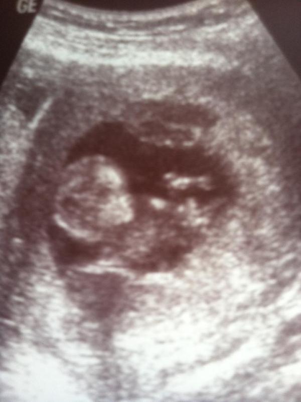 MelaNoMo's tweet image. Congrats are in order for our founder + inspiration... Neil Gaines is going to be a daddy!! #blessed