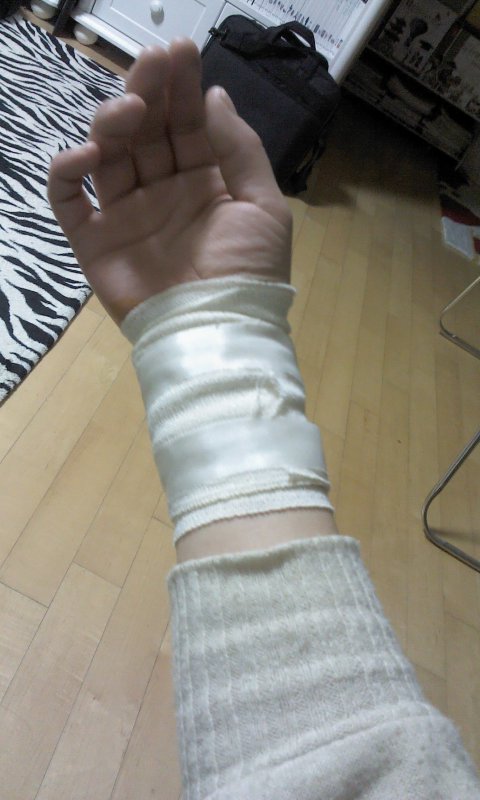 jmi925's tweet photo. 팔에 바느질좀했당....  나이들어. 조심해야징... http://t.co/Glvq6zUr