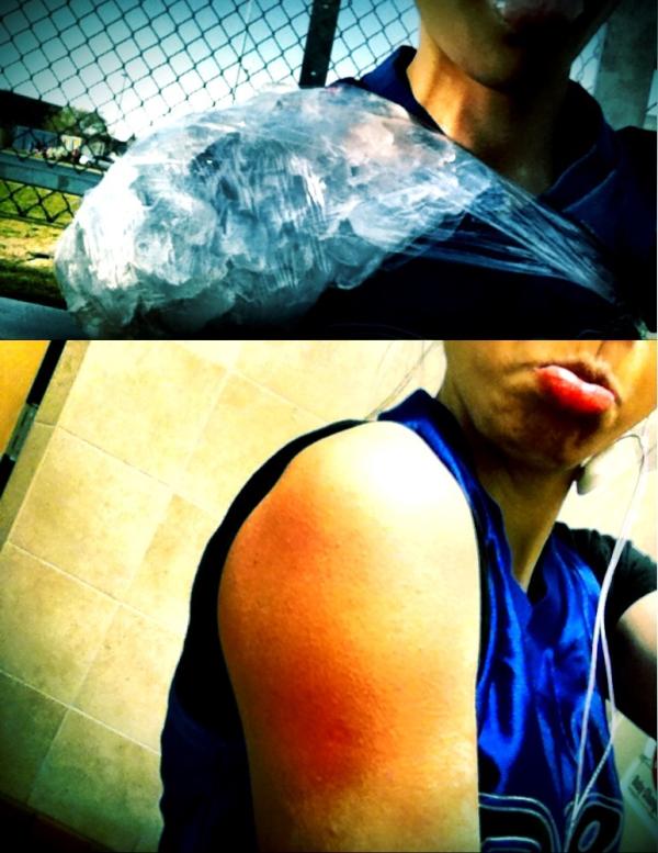 WeezieNickie's tweet image. my entire body is sore, especially my shoulder. lmao and today, my pinky wouldn't close xD #okaygoodnight &amp;lt;3