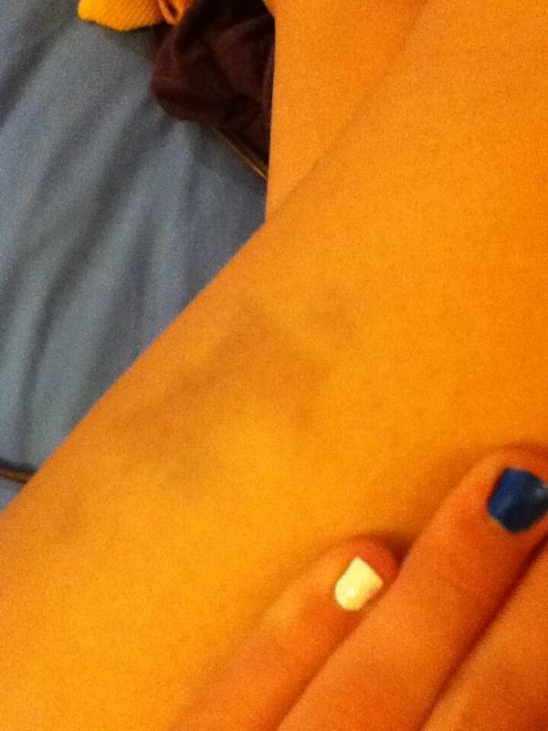 DropDeadBlondie's tweet image. My leg was hurting like a bitch, and then I found this beautiful bruise. #pitcherproblems #sexy