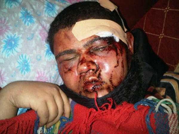 A kid beaten brutally by the riot police and the regime thugs, is this humanity ? #SavebhKids