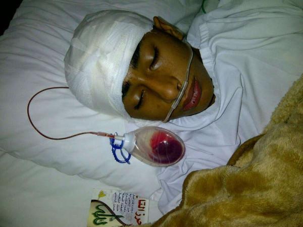 13 y/o child has a fracture in his skull due to police brutality, he was shot with tear gas can #SaveBHKids #Bahrain