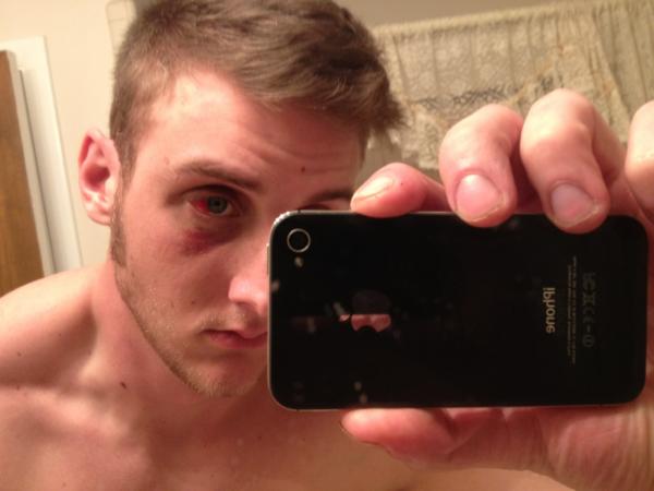 Nichols31Tn's tweet image. One week late and I still have a #DevilEye