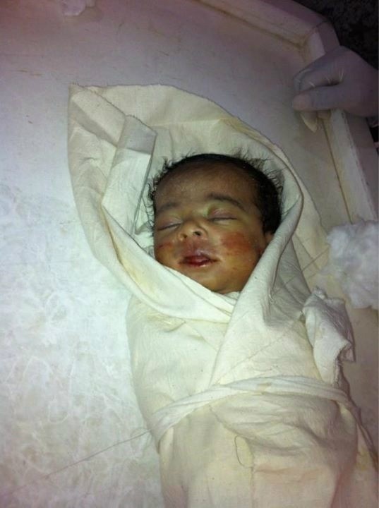 OMG!!! #SaveBHkids !! OMG !!!
RT“@bahpower: #today another victim killed by #poisengas fired by #bahrain #police
”