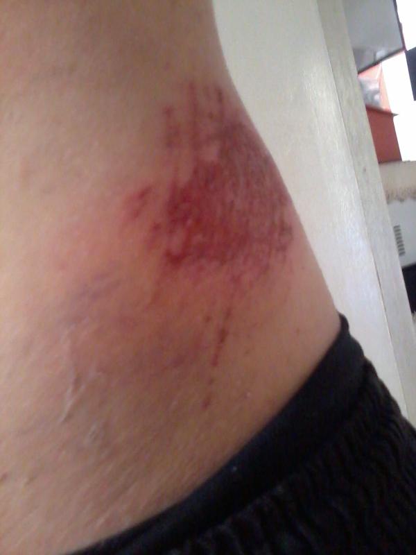 Lucaslambert's tweet photo. @niniiscrimon  fico uma marca bem pequeninha olha ai  OASISAIOASIOS http://t.co/ccFziaw5