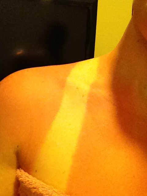 MegMcQuaide's tweet image. Nope I'm not burnt at all... #megproblems